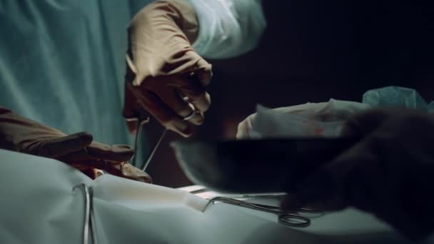 クランプ手術室の閉鎖を使用して外科医の手。集中治療室. — ストック動画