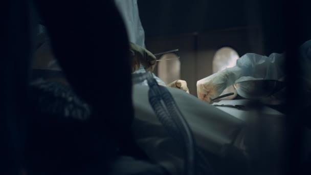 의사 팀 손으로 불임 수술 도구를 사용하여 수술을 하는 모습. — 비디오