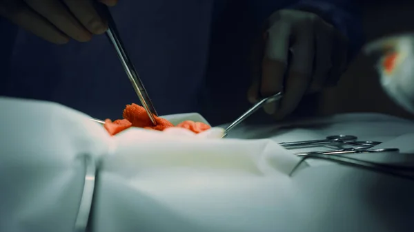 Руки крупного хирурга оперируют в стерильном отделении клиники. Медицинская команда сотрудничает. — стоковое фото