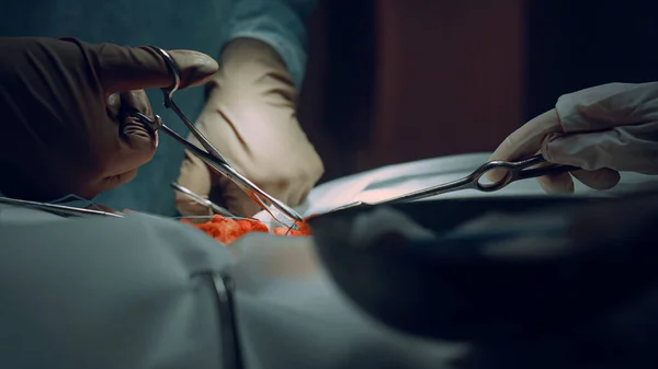 Zbliżenie chirurg ręce szycie rany po udanej operacji w klinice. — Zdjęcie stockowe