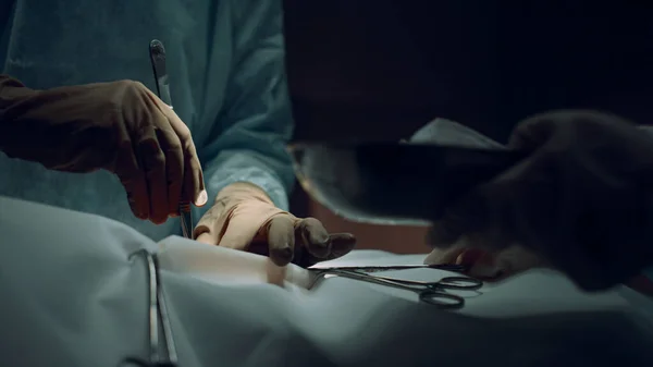 Assistant handing surgery tools to practitioner dark operating theater closeup. — стоковое фото