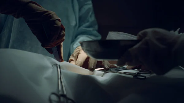 Cirujano manos haciendo incisión utilizando bisturí en la sala de hospital oscuro de cerca. —  Fotos de Stock