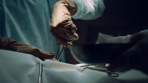 Cerrah elleri klemp ameliyathanesini kullanıyor. Hastane yoğun bakım ünitesi.. — Stok fotoğraf
