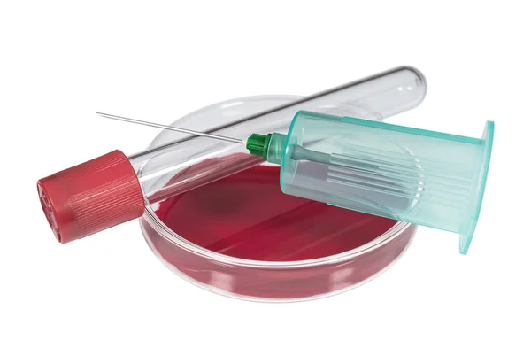 Placa Petri Vacutainer Con Muestra Sangre Sobre Fondo Blanco Salud — Foto de Stock