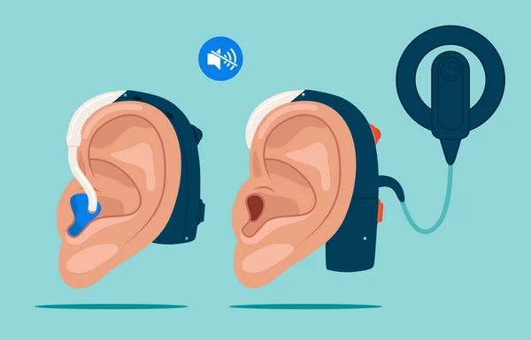 Kožní Implantát Naslouchátko Světový Den Neslyšících Minulou Neděli Září Plochá — Stockový vektor