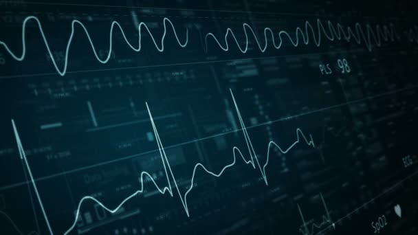 ΗΚΓ αφηρημένη HUD.Καρδιακό ρυθμό γραμμή template.Cardiogram οθόνη. — Αρχείο Βίντεο