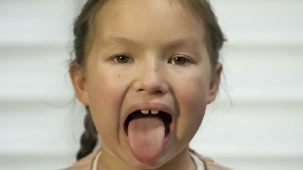 Girl of 7-8 years old diligently shows her tongue. Perhaps at a doctors appointment. — Αρχείο Βίντεο