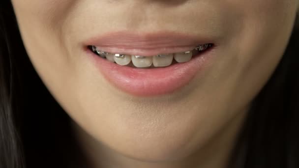 Beautiful macro shot of white teeth with braces.Beauty woman smile with ortodontic accessories. Orthodontics treatment. Closeup of healthy female mouth. — Stock video