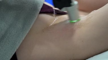 Modern kozmetoloji kliniğinde lazer tüy çıkarma işlemi sırasında kadın koltuk altı bölgesini kapatın. Kadın güzellik kavramı, kozmetoloji, epilasyon