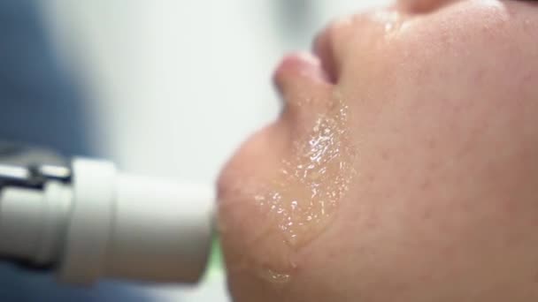 Zbliżenie kobiety twarz nowoczesny alexandrite laserowej procedury usuwania włosów. Pojęcie kobiecej urody, kosmetologii, depilacji — Wideo stockowe