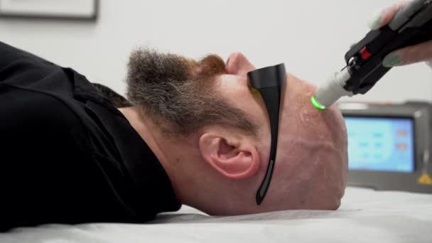 Primer plano barbudo hombre audaz depilación de la cabeza láser tratamiento de eliminación de cabello, procedimiento poco doloroso, concepto de belleza, láser de alexandrita — Vídeos de Stock