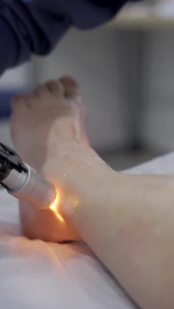 El vídeo vertical primerísimo del cosmetólogo profesional que hace la depilación láser de las piernas a la mujer joven en el salón de belleza — Vídeos de Stock