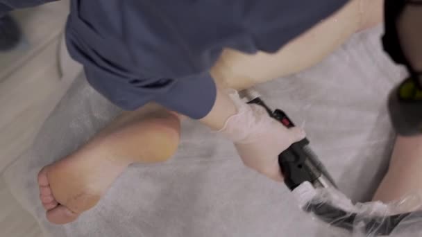 Κάθετη κοντινό βίντεο του επαγγελματία κοσμητολόγου κάνει λέιζερ αποτρίχωση των ποδιών σε νεαρή γυναίκα στο σαλόνι ομορφιάς — Αρχείο Βίντεο