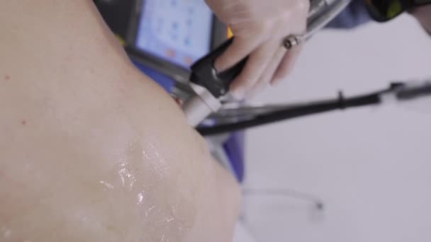 Göğüs ucu tüy dökücü lazer temizleme prosedürü tedavisini kapat — Stok video