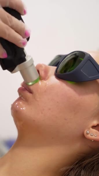 Zbliżenie Kobiety Twarz Nowoczesny Alexandrite Zabieg Laserowego Usuwania Włosów Salonie — Wideo stockowe