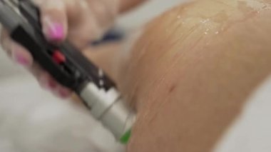 Profesyonel kozmetolojistin, güzellik salonundaki genç bayana, vücut bakımı epilasyonu tedavisinde lazer kılı kesme videosunu kapatın. Güzellik konsepti.