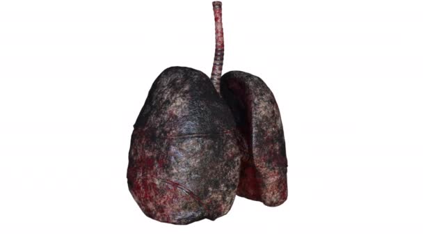 喫煙者の肺 — ストック動画