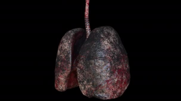 Sigara içen birinin akciğerleri — Stok video