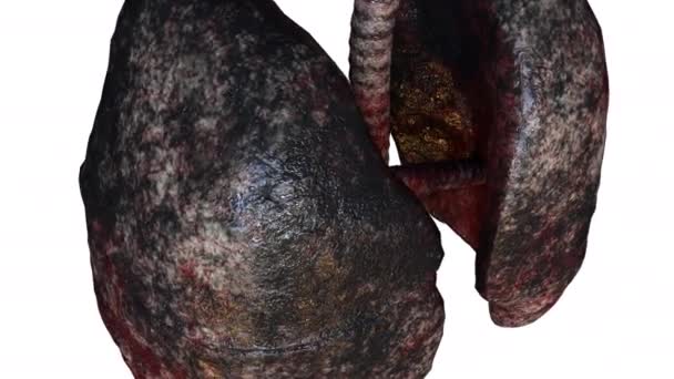 Plămânii umani ai fumătorului — Videoclip de stoc