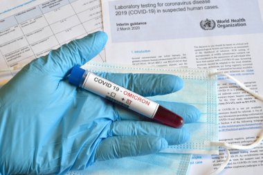 Florence, Aralık 2021: Covid 19 virüsünün yeni Omicron versiyonu. Doktorun elinde mavi eldiven, üzerinde pozitif Omicron COVID 19 test kan örneği ve koruyucu tıbbi maskeler ve arka planda belgeler bulunan test tüpü tutuyor..