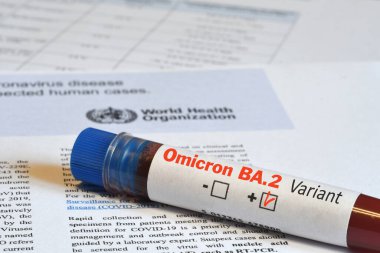 Florence, Mart 2022: Covid-19 Omicron BA.2 virüsünün test tespiti için kan tüpü.