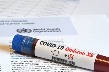 Florence, Nisan 2022: Covid-19 Omicron XE Varyantı virüsünün tespiti için kan tüpü.