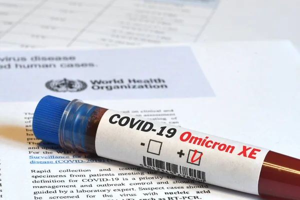 Florence April 2022 Bloedbuis Voor Detectie Van Virus Covid Omicron — Stockfoto