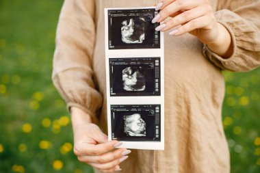 Ultrason görüntülerini taşıyan hamile bir kadının kesilmiş fotoğrafı ve fotoğraf için poz vermesi. Parkta çimlerin üzerinde duran bir kadın. Hamilelik konsepti, doğum ve aşk..