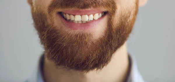 Vista de cerca de toothy blanco amplia sonrisa masculina sobre fondo gris estudio en blanco —  Fotos de Stock