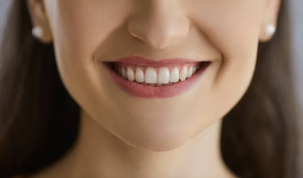 Primer plano de una sonrisa feliz de las mujeres jóvenes con los dientes blancos perfectos incluso sanos —  Fotos de Stock