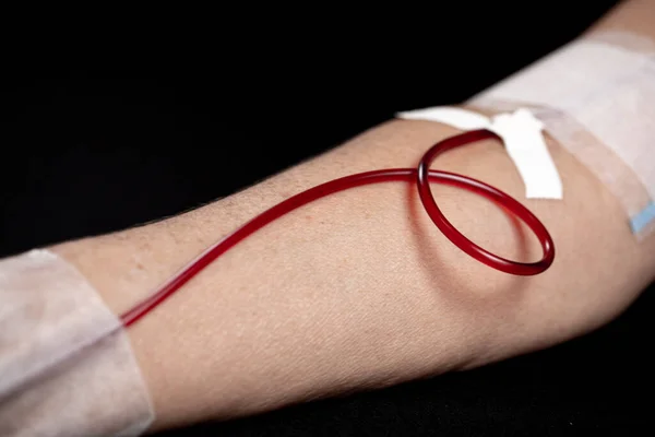 Donación Voluntaria Sangre Sobre Marcha Hemodiálisis — Foto de Stock