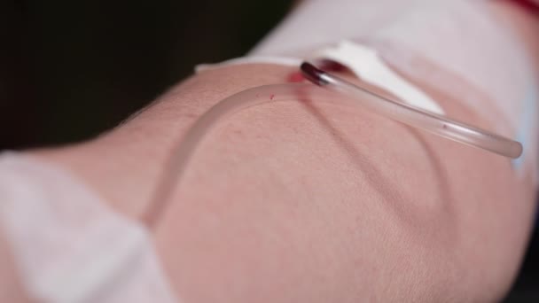 Doação Voluntária Sangue Movimento Hemodiálise — Vídeo de Stock