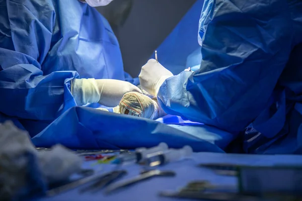 Surgical Center Procedure Fistula Dialysis Focus Selective Defocused — Foto de Stock