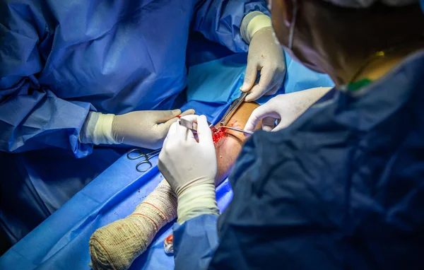Surgical Center Procedure Fistula Dialysis Focus Selective Defocused — Foto de Stock