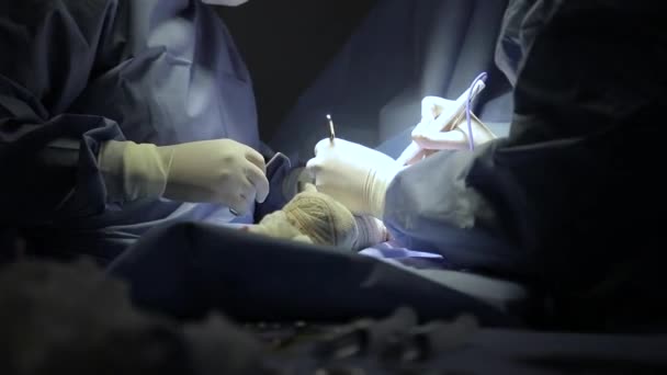 Surgical Center Procedure Fistula Dialysis Focus Selective Defocused — Video Stock