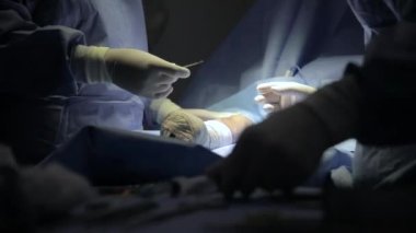 surgical center in procedure fistula for dialysis focus selective and defocused