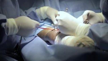 surgical center in procedure fistula for dialysis focus selective and defocused