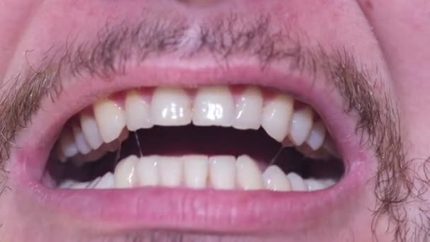 Νεαρός με υγιή δόντια που δείχνει ίσια δόντια κάνει κλικ πάνω τους. Κλείσε. — Αρχείο Βίντεο