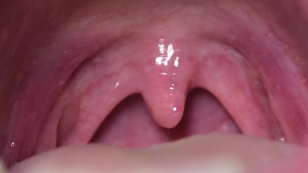 Macro membuka mulutnya dengan sakit tenggorokan. — Stok Video