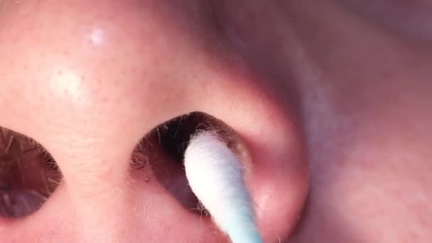 Un homme se teste sur un Covid 19 avec un tampon dans le nez. — Video