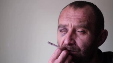 Sarhoş bir adam gözünün altında mavi bir hematom ile sigara içiyor.. 