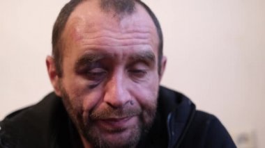 Alkolizm, alkol bağımlılığı. Tıraşsız bir adam alkoliktir..