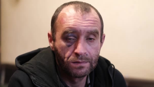 Betrunkener nachdenklicher Mann mit Hämatom unterm Auge. — Stockvideo