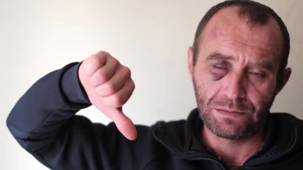 En man med ett hematom under ögat visar en gest av nej. — Stockvideo