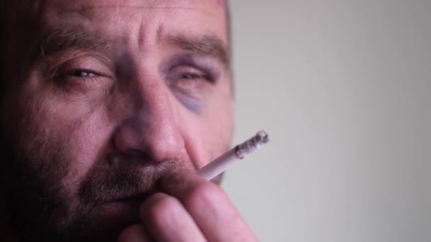 Alkol zehirlenmesi olan bir adam gri arka planda sigara içer. Gözünün altında hematom olan bir adam.. — Stok video