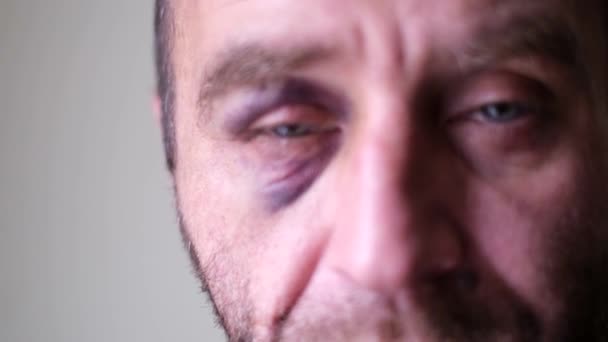 La cara de un hombre cansado de cerca, que está después de una borrachera pesada — Vídeo de stock