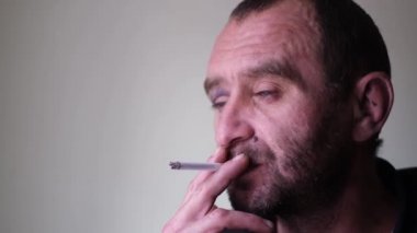 Alkol bağımlısı bir adamın yüzünde hematom var. Bir alkoliğin yüzü 