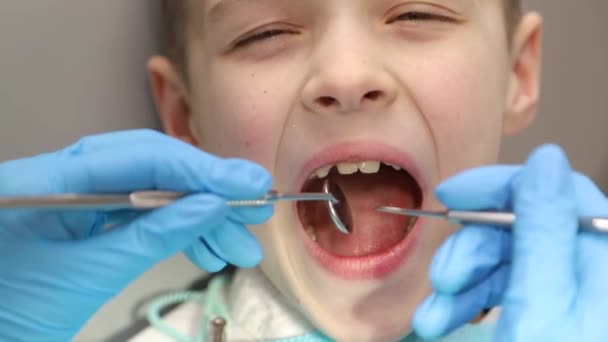 Barnet är hos tandläkaren, tandläkaren undersöker mjölktänderna. Smärtfri tandvård, karies hos barn — Stockvideo
