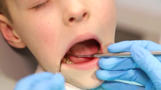 Дитина у стоматолога, стоматолог оглядає зуби дитини. Безболісне лікування зубів, карієс у дітей — стокове відео