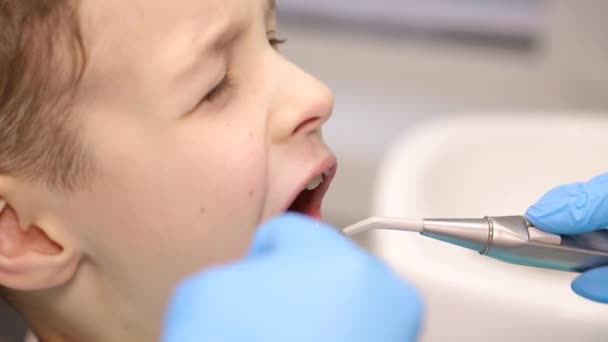 Tandvård. Tandläkaren undersöker mjölktänder. Närbild, tandvård för barn, begreppet en frisk mun. — Stockvideo